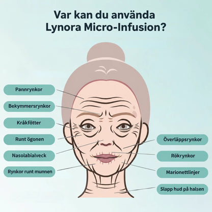 Lynora Micro-Infusion Anti-Aging Kit™